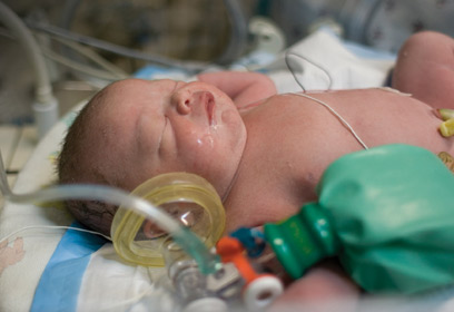 Photographie d'un nouveau-né prématuré